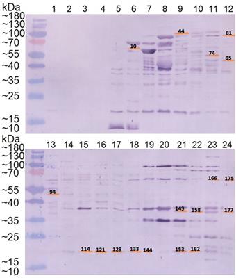 An immunoproteomics study of antisera from patients with gonorrhea identifies novel Neisseria gonorrhoeae proteins